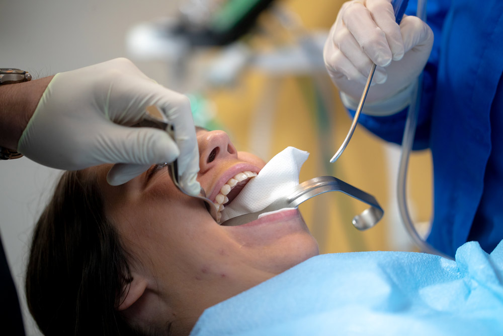 جراحی دندان عقل دکتر رامتین صیحانی