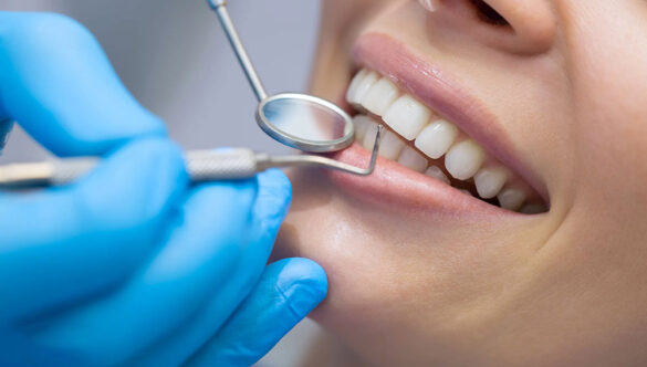 اصطلاح ترمیم دندان یعنی چه و به چه کارهایی گفته می‌شود؟