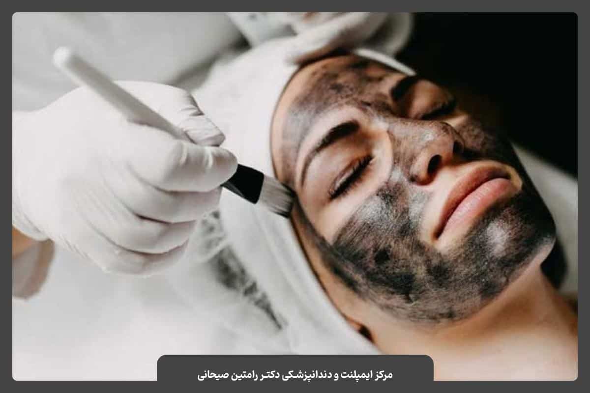 پاکسازی پوست به روش پیلینگ هالیوودی